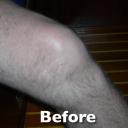 knee.jpg